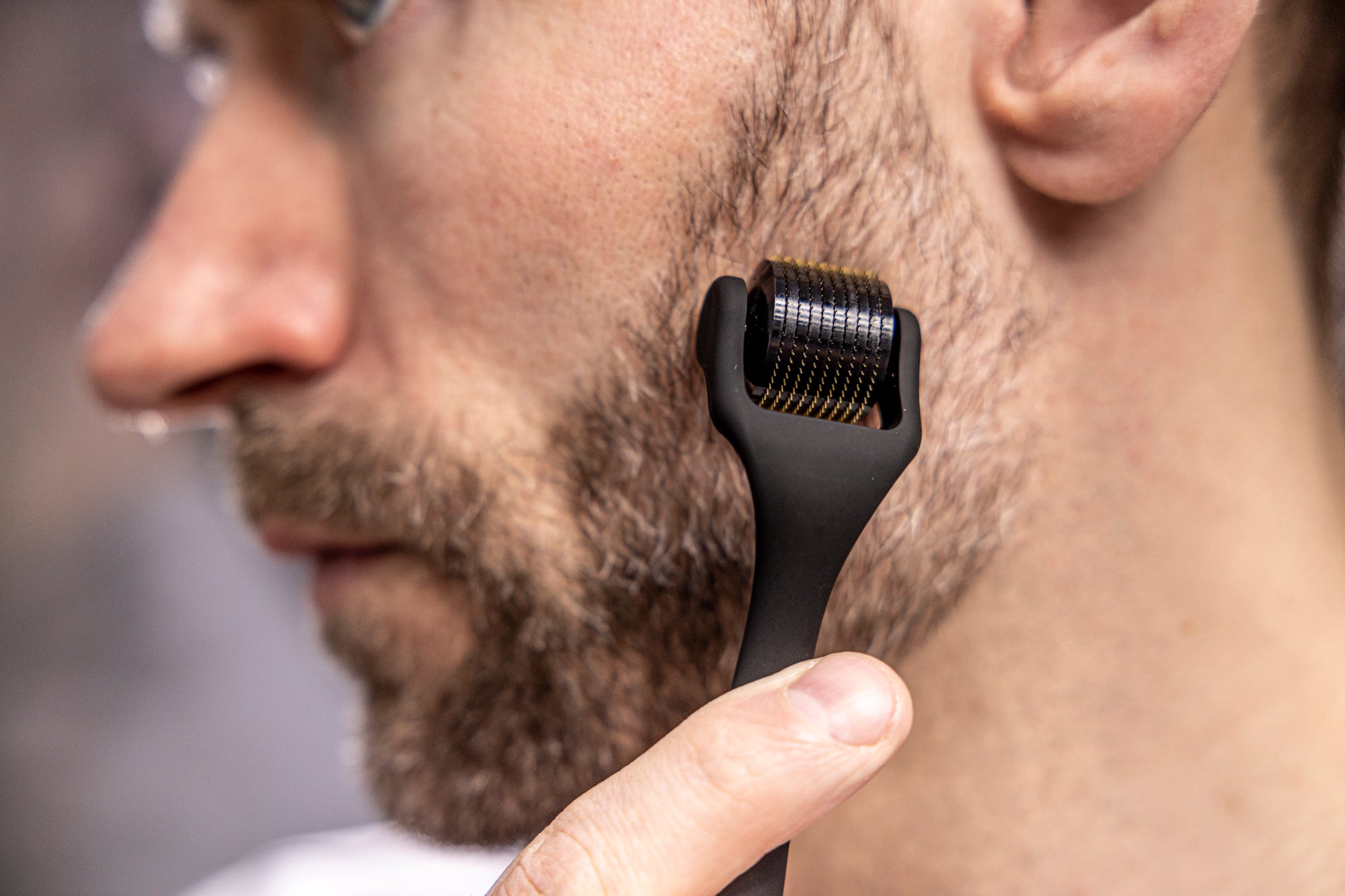 ORM Scalp Roller | Scalp Roller 1mm