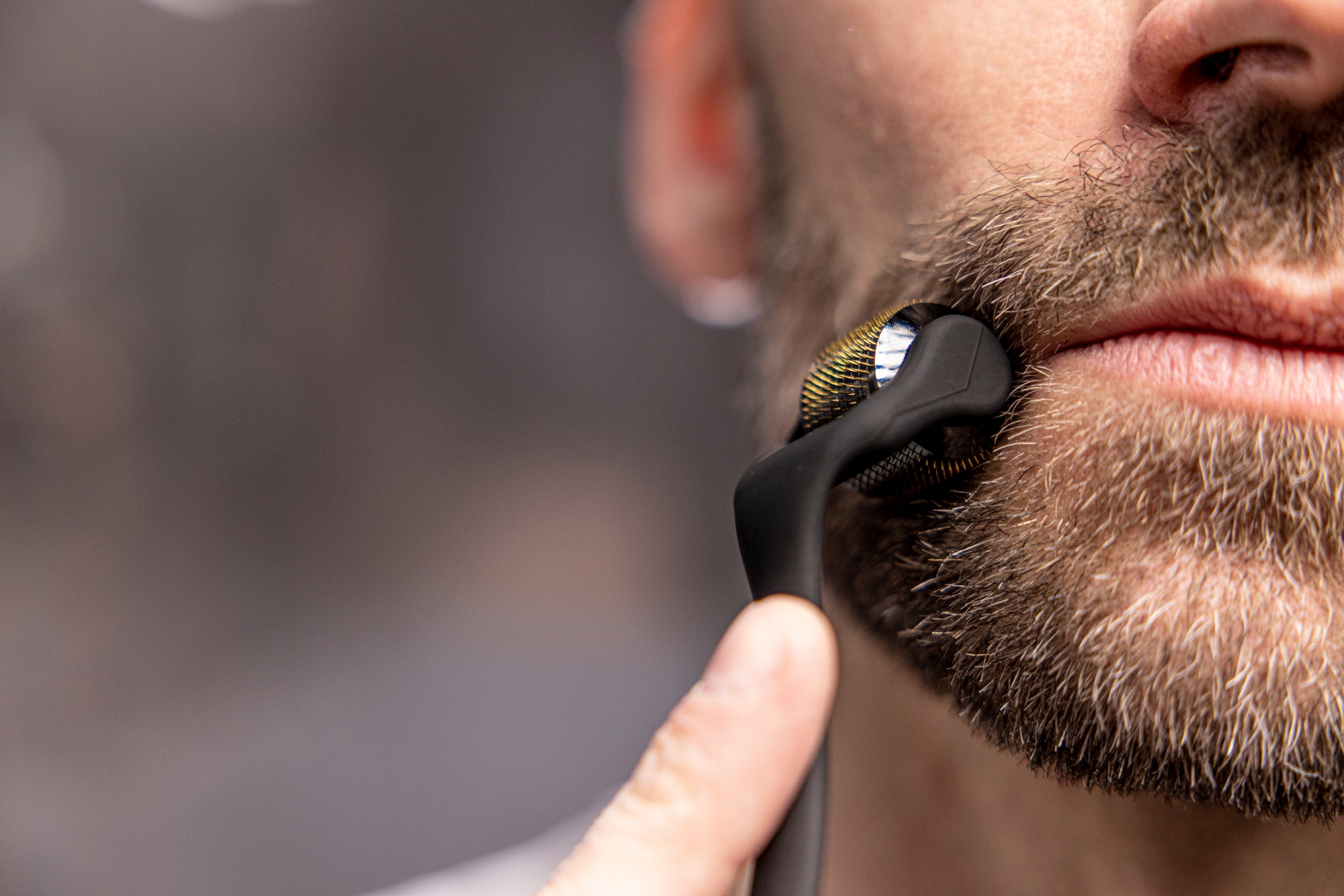 ORM Scalp Roller | Scalp Roller 1mm